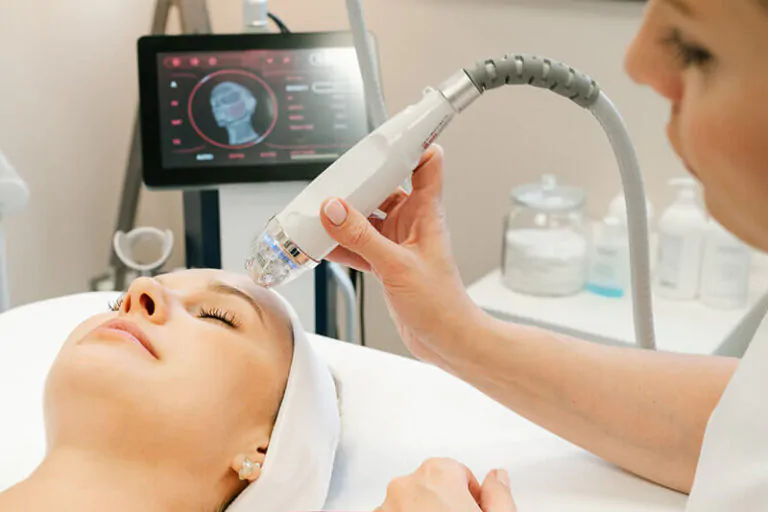Microneedle Radiorefractive Rf Lifting Without Scalpel