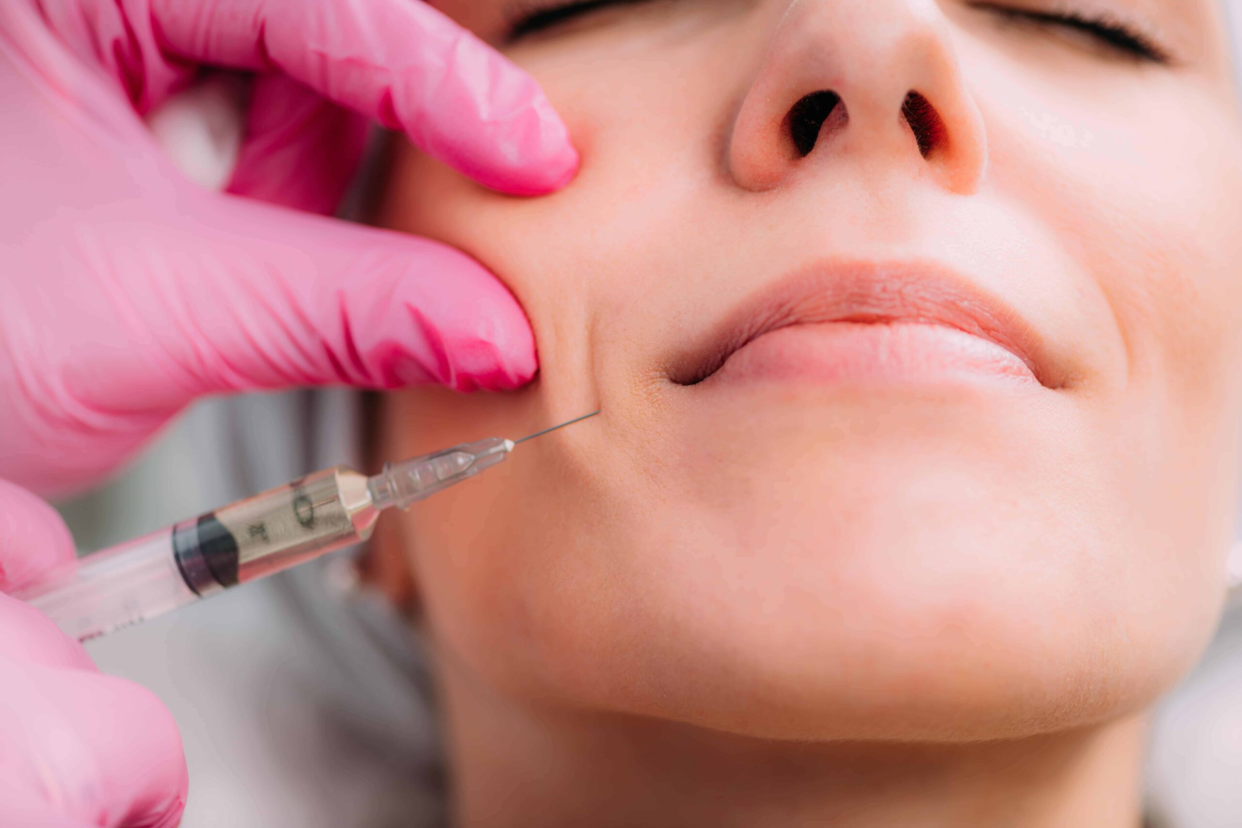 Tissue Biostimulators